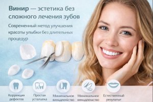 Лечение зубов винирами в стоматологии: эстетика без сложного лечения зубов