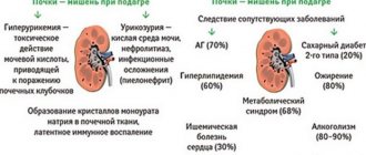 Поражение почек при подагре