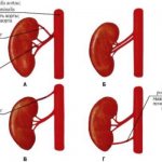Причины, виды, клиническая картина добавочной почечной артерии