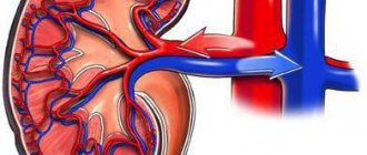 стеноз почечной артерии